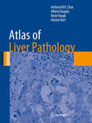 cover image of Atlas of Liver Pathology
